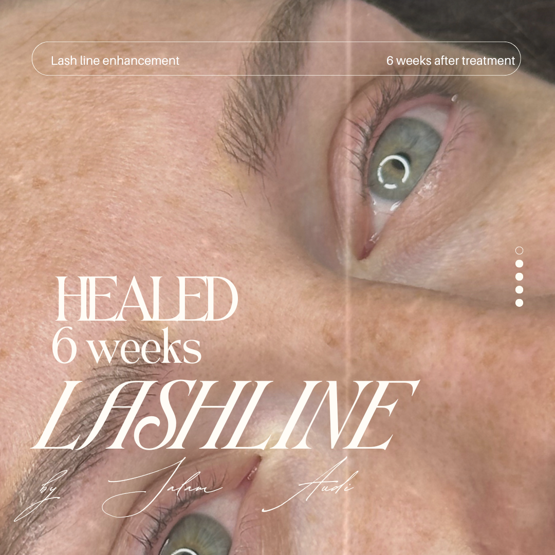 Lash-line enhancement Course